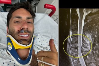 Thrilling Twist: Nev Schulman Faces Life-Altering Bike Accident