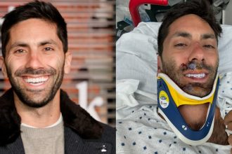 Catfish Star Nev Schulman Reveals Shocking Injury: ‘I Broke My Neck in a Truck Collision – C5 and C6, to Be Exact!