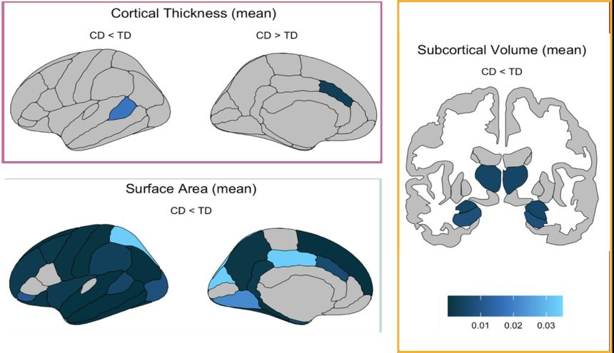 Unraveling the Mind: How Conduct Disorder Transforms Brain Structures in Youth