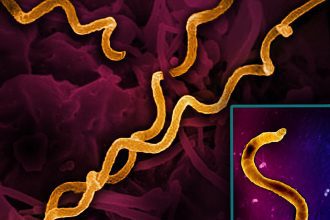 Revolutionizing Syphilis Detection: NIH Awards Propel Cutting-Edge Diagnostic Innovations