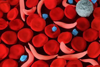 Hidden Dangers: How Sickle Cell Disease Carriers Face Elevated Blood Clot Risks Across All Ancestries!